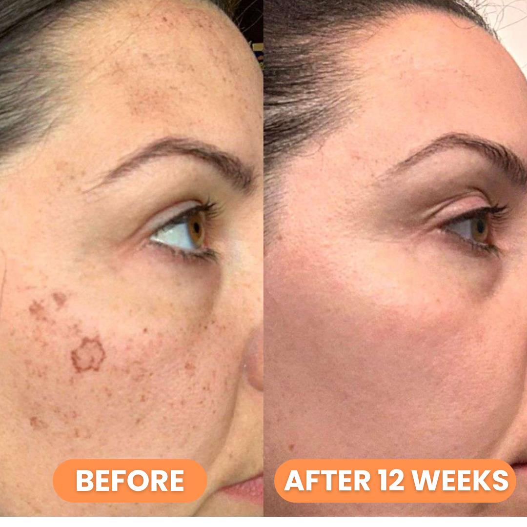 Celimax Pore+Dark Spot Brightening Cream 35ml