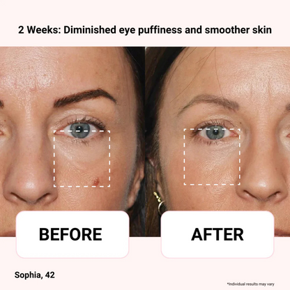Axis‑Y Vegan Collagen Eye Serum | 100% Authentic Korean Eye Serum