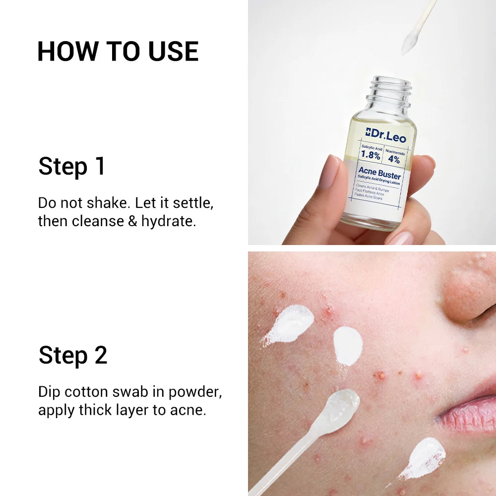 Dr.Leo Acne Drying Lotion Plus (1.8% Encapsulated Salicylic Acid) — 20 mL