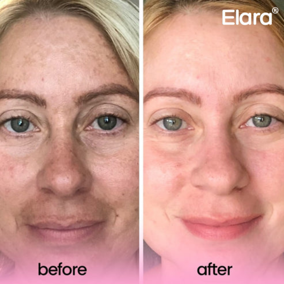 Phor Essentials® Kojic Acid Turmeric Cleansing Pads