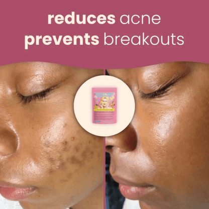 Elara™ Premimum Kojic Acid Turmeric Cleansing Pads