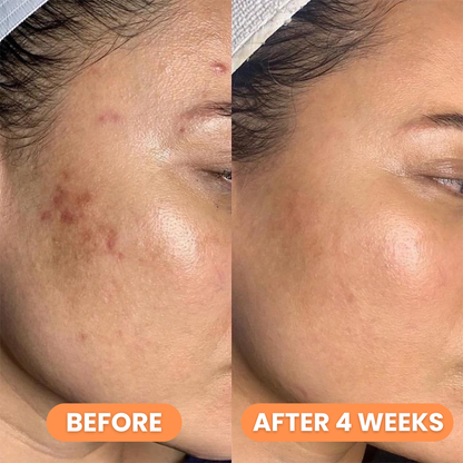 Celimax Pore+Dark Spot Brightening Cream 35ml