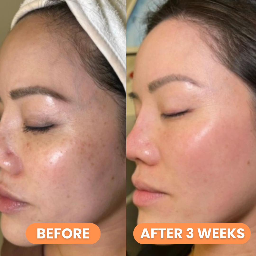 Celimax Pore+Dark Spot Brightening Cream 35ml