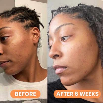 Celimax Pore+Dark Spot Brightening Cream 35ml