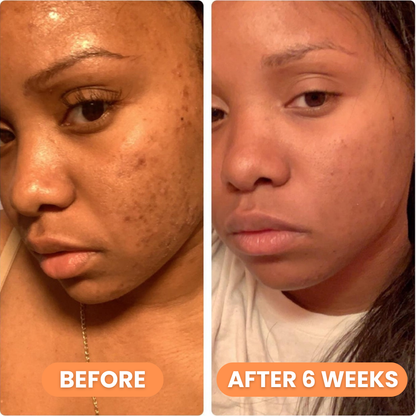 Celimax Pore+Dark Spot Brightening Cream 35ml