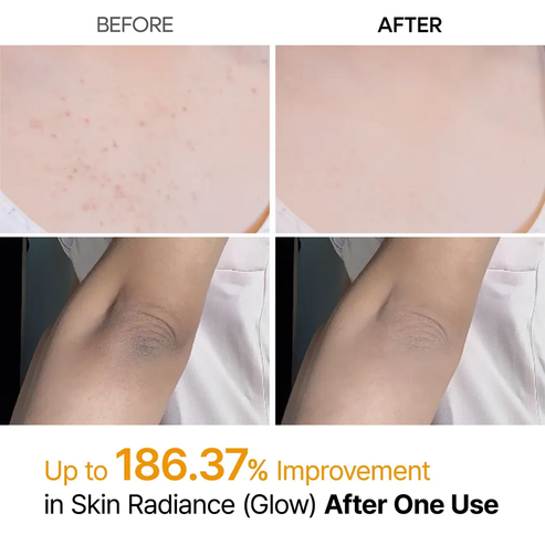 Dr.Melaxin® Peel Shot | Exfoliating Kojic Acid Turmeric Spray 200ml