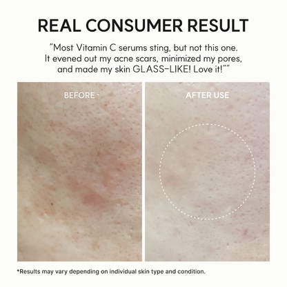 Arencia Vitamin C Booster Shot Serum