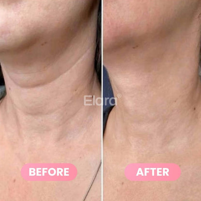 Medicube® PDRN Collagen Gua Sha Neck Wrinkle Cream 90g