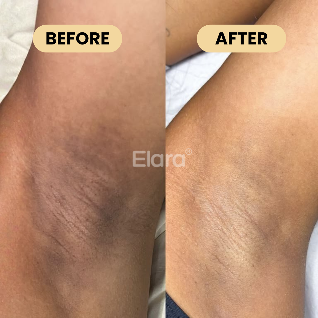 Medicube® Kojic Acid & Turmeric Aluminum-Free Deodorant