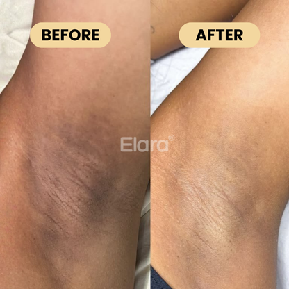 Medicube® Kojic Acid & Turmeric Aluminum-Free Deodorant