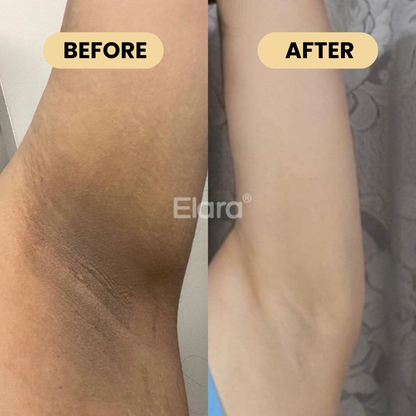 Medicube® Kojic Acid & Turmeric Aluminum-Free Deodorant