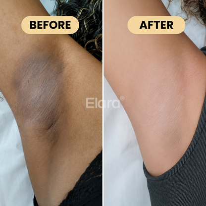 Medicube® Kojic Acid & Turmeric Aluminum-Free Deodorant
